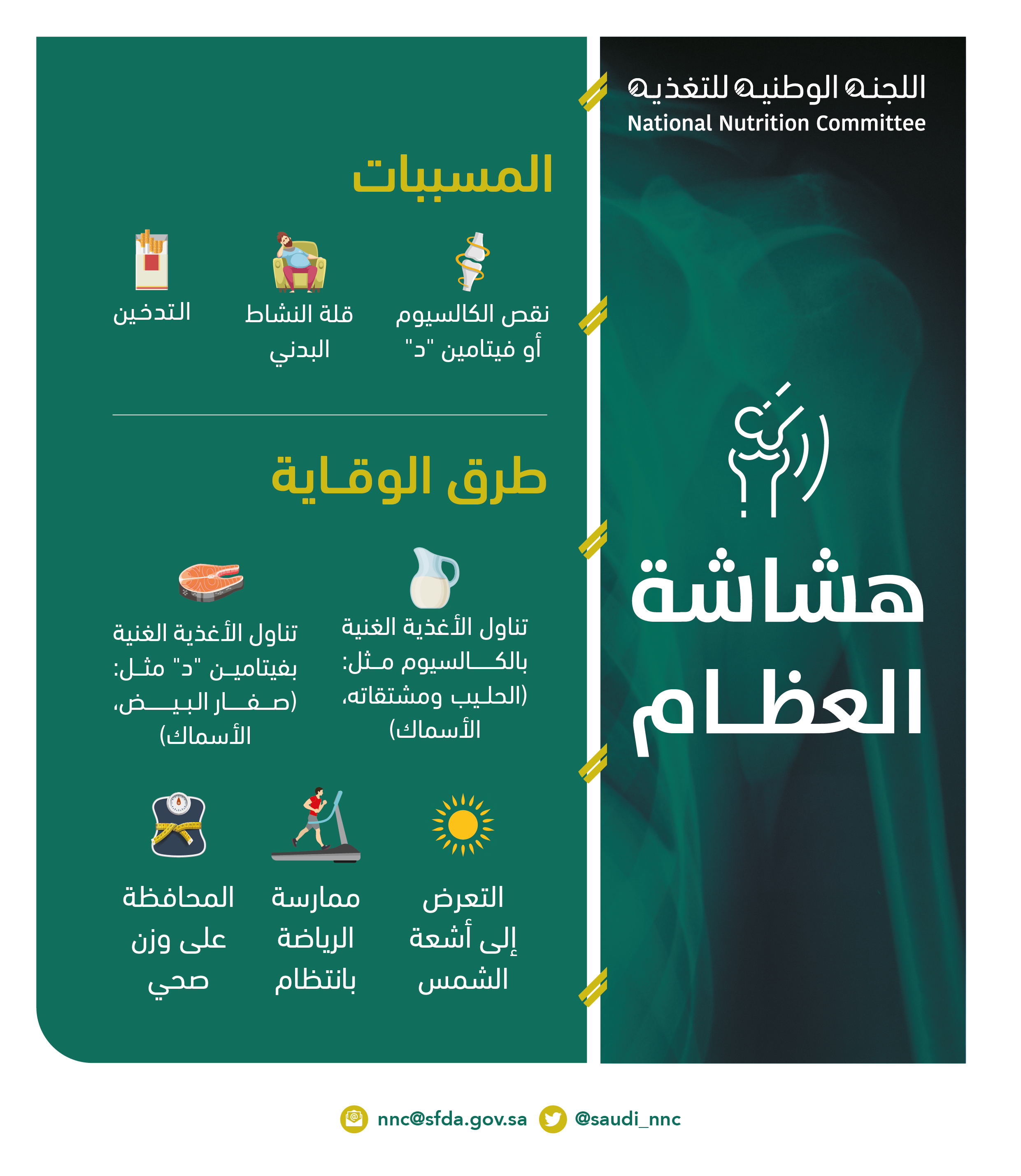 التدخين وإهمال النشاط البدني أهم الأسباب المؤدية لهشاشة العظام